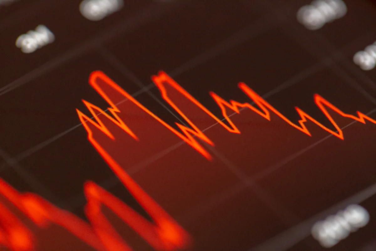 Falling red trend line representing negative retained earnings or a deficit